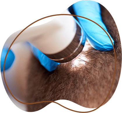 Hair detail examination under microscope